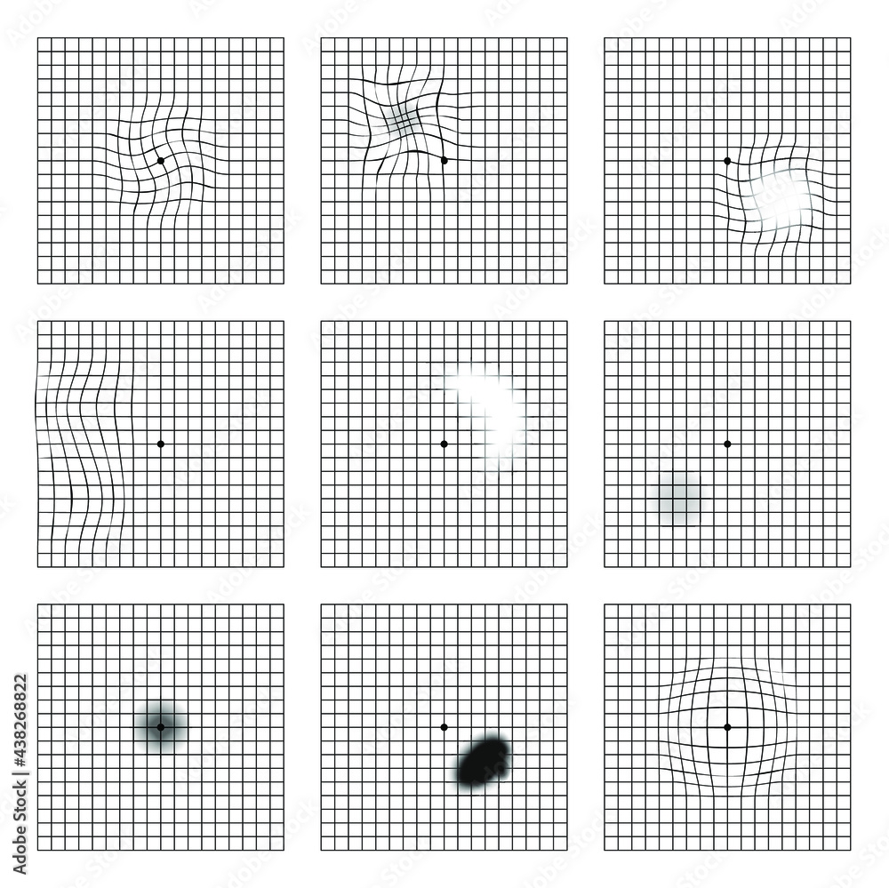 Amsler Grid Scotoma Eye Test Oculist Vector Printable Chart Retina Examination Grid With Dot In Centre Vision Control Stock Vector Adobe Stock