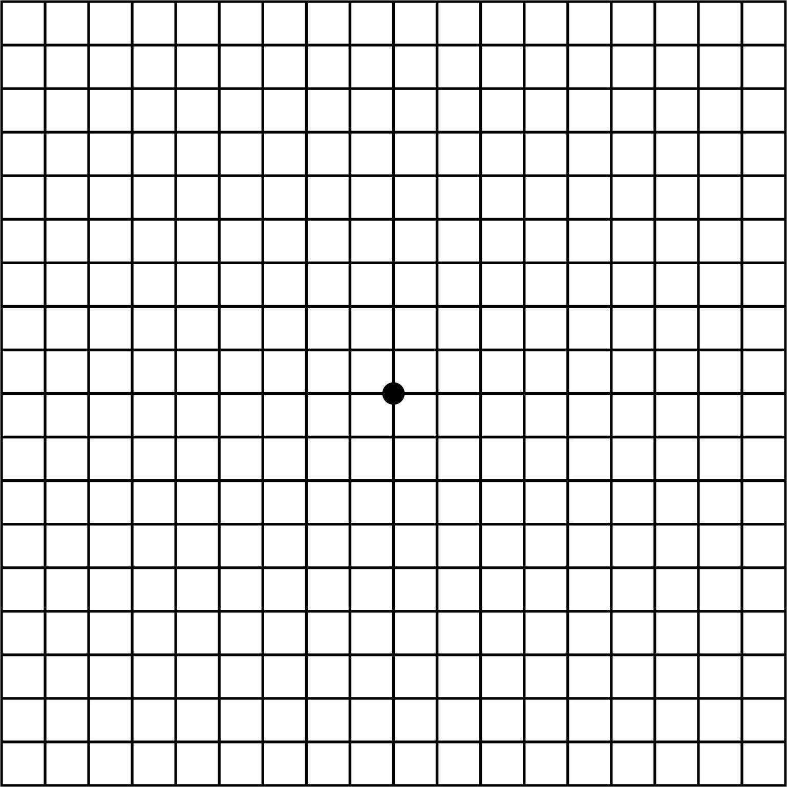 Amsler Grid