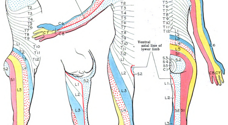 Figure Dermatome Map A Dermatome Is An StatPearls NCBI Bookshelf